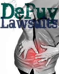 DePuy Lawsuits images