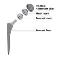 Depuy Pinnicle images