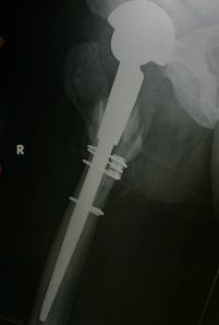 X-Rays 30 Sept 2011 013 CR